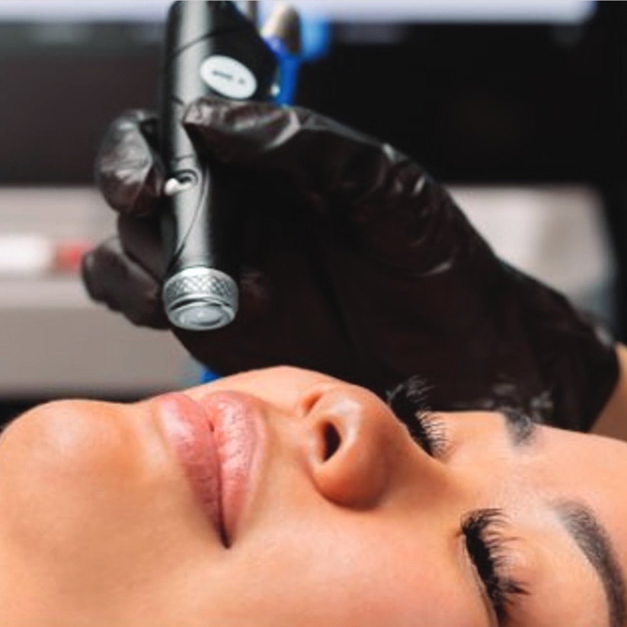 Hydrafacial